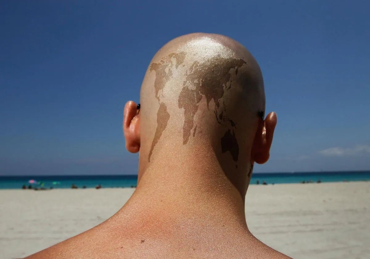 Why is Spain the country with the highest percentage of baldheaded men